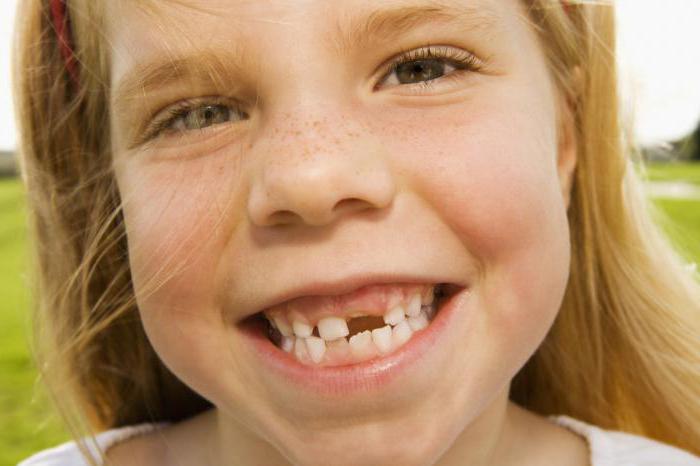 Выпадение молочных зубов у детей 5 лет