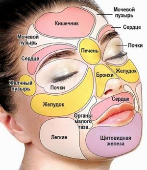 Особенности лечения прыщей на лице